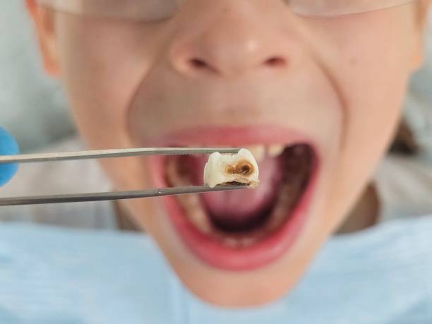 Best Broken Tooth Emergency  in Echelon, NJ