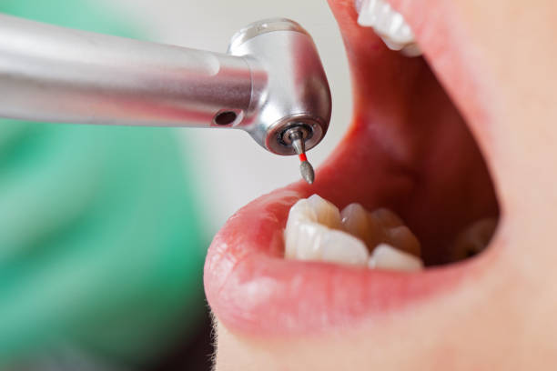 Teeth Whitening in NJ